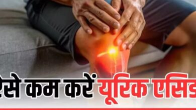 Photo of High Uric Acid के लेवल को कम कर देते हैं ये फूड्स