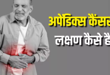 Photo of मिलेनियल्स में तेजी से बढ़ रहे हैं Appendix Cancer के मामले